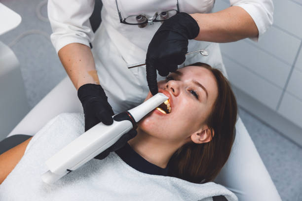 Best Emergency Wisdom Tooth Extraction in Lacey, WA